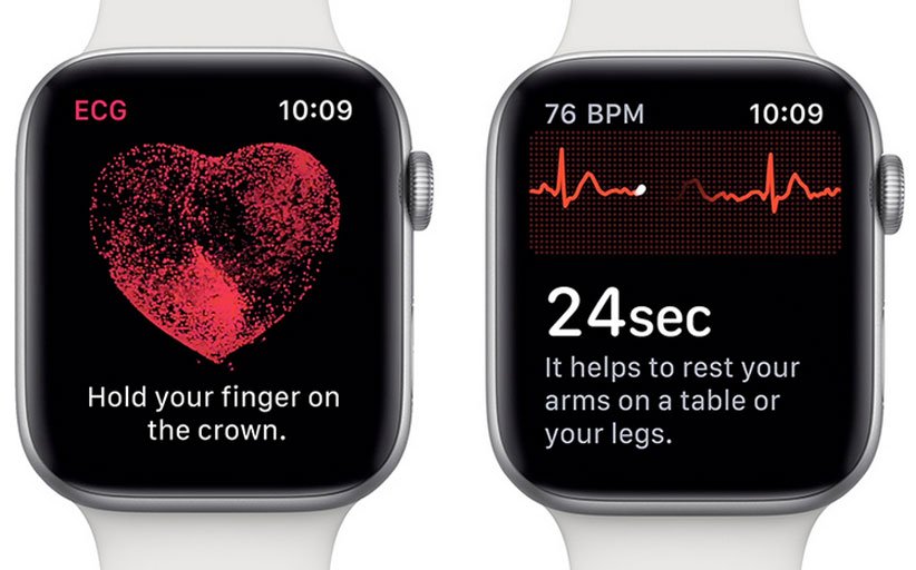Heart health features of Apple Watch